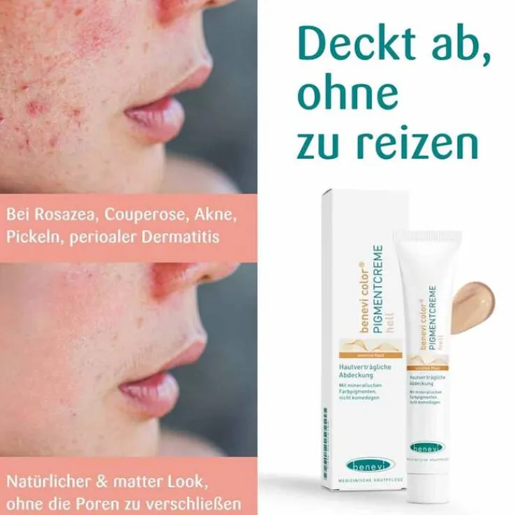 Benevi Color Pigmentcreme hell, 20 ml