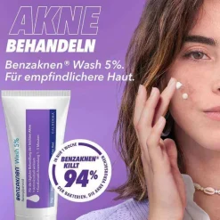 Benzaknen ® Wash 5% Suspension bei unreiner Haut und leichter Akne, 50 g> Akne-Creme