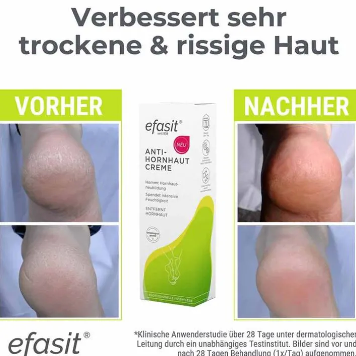 Efasit Anti-Hornhaut Creme, 75 ml> Hornhaut