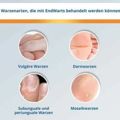 EndWarts® CLASSIC Lösung, 3 ml