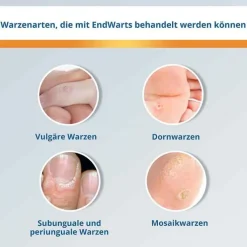 EndWarts® FREEZE Spray, 7.5 g