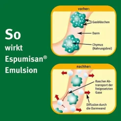 Espumisan Emulsion, 30 ml>Kinder Medikamente Gegen Blähungen|Mittel Gegen Blähungen