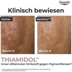 Eucerin Anti-Pigment Teint perfektionierendes Serum, 30 ml><noscript><img width=