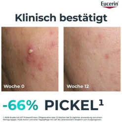 Eucerin Dermopure Clinical Triple Action Creme, 40 ml