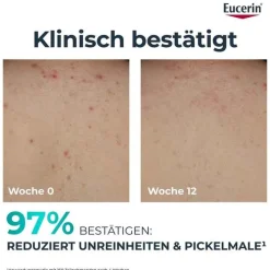 Eucerin Dermopure Clinical Körperpflege erneuernd, 200 ml><noscript><img width=