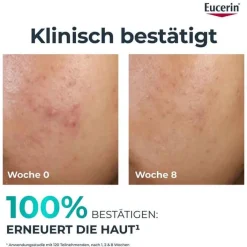 Eucerin Dermopure Clinical Peeling 10 Nachtcreme, 40 ml><noscript><img width=