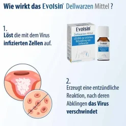 Evolsin Dellwarzen Mittel Lösung, 5 ml><noscript><img width=