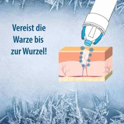 Evolsin ® Warzenvereiserspray, 75 ml><noscript><img width=