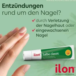 ilon® Salbe classic, 100 g