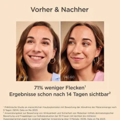 Isdin ceutics Melaclear Serum, 30 ml><noscript><img width=