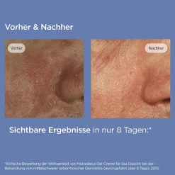 Isdin Nutradeica Gel-Creme Gesicht, 50 ml><noscript><img width=