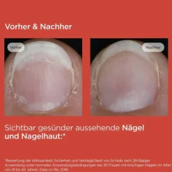 Isdin Si-Nails Nagelhärter Stift, 2.5 ml><noscript><img width=