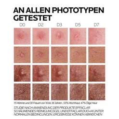 La Roche Posay Effaclar Duo + M Creme, 40 ml