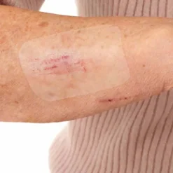 Leukomed ® T skin sensitive 8x10 cm, 5 St><noscript><img width=