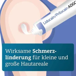 Lidocain / Prilocain ADGC 25 mg / g + 25 mg / g Creme, 30 g