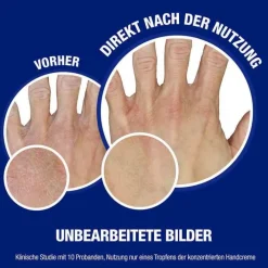 Neutrogena norwegische Formel Hand & Nagel Creme, 75 ml><noscript><img width=