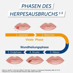 Pencivir bei Lippenherpes Creme, 2 g