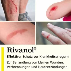 Rivanol Salbe, 50 g