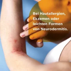 Soventol ® HydroCort 0,5% Creme bei akuten Hautentzündungen, 30 g><noscript><img width=