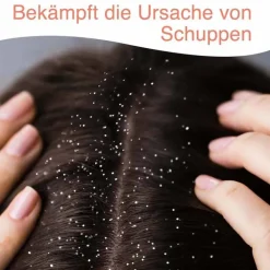 Stieprox Intensiv Shampoo, 100 ml><noscript><img width=