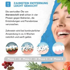 Theranovis oral Zahnstein Spray, 65 ml