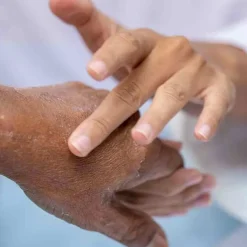 Urea / Harnstoffsalbe 10% ig, 250 g