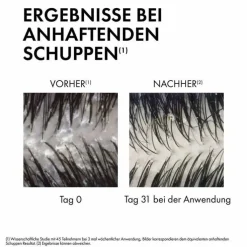 Vichy Dercos Anti-Schuppen Shampoo trockene Kopfhaut , 500 ml